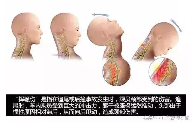 三秒知识点：不舒服的汽车头枕有存在的必要吗？