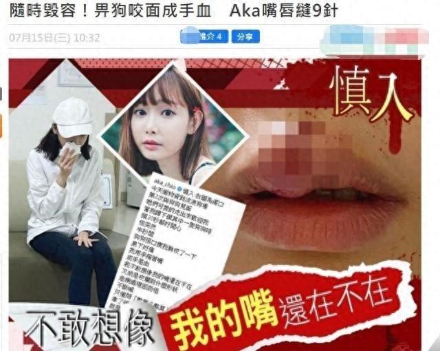 知名女星被流浪狗咬伤，面部缝9针险毁容，52岁周慧敏留言关心