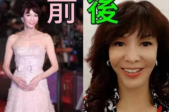 曾经也是美丽明艳，却因整容毁掉一切，这6位女星全是反面案例！