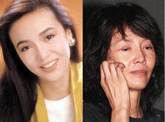 曾经也是美丽明艳，却因整容毁掉一切，这6位女星全是反面案例！