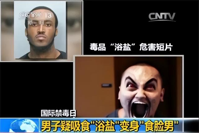 “丫丫”到底怎么了？骨瘦如柴、毛发脱落 → 网友：像吸毒了一样！